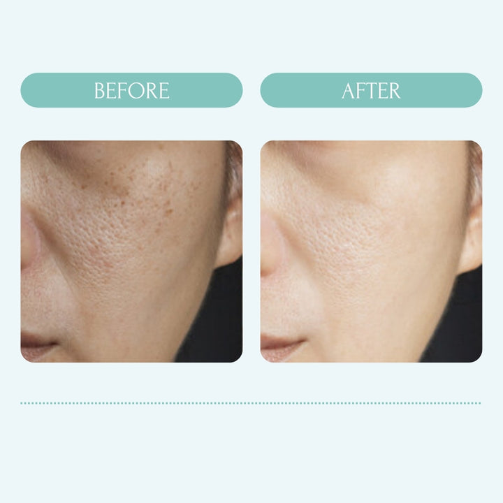 Rice Revive Cream with Shea Butter - MEABIA